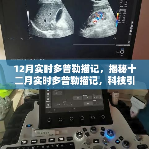 揭秘十二月实时多普勒描记，科技引领医学新突破