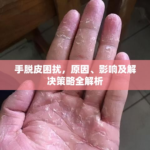 手脱皮困扰，原因、影响及解决策略全解析
