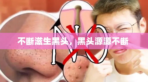 不断滋生黑头，黑头源源不断 