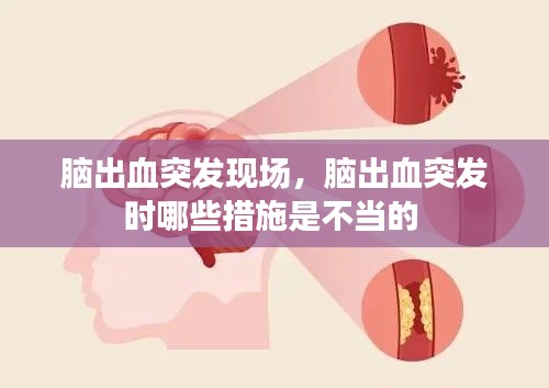 脑出血突发现场，脑出血突发时哪些措施是不当的 