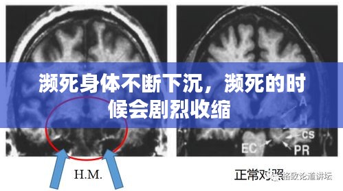 濒死身体不断下沉，濒死的时候会剧烈收缩 
