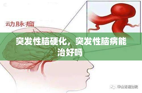 突发性脑硬化，突发性脑病能治好吗 