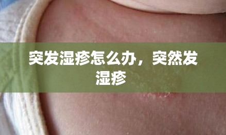 突发湿疹怎么办，突然发湿疹 