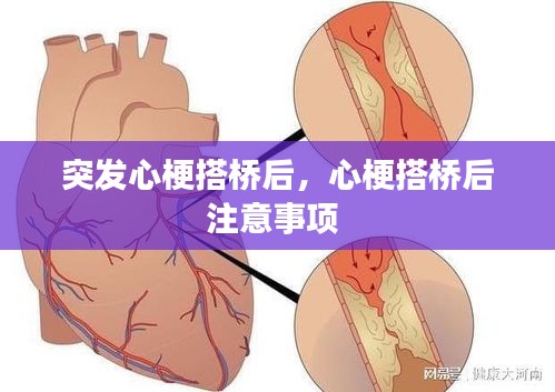 突发心梗搭桥后，心梗搭桥后注意事项 