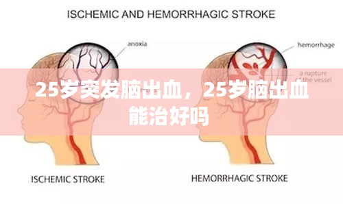 心急如焚 第2页