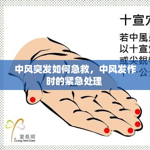 中风突发如何急救，中风发作时的紧急处理 