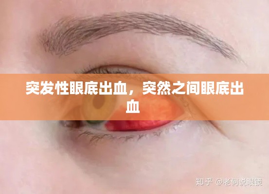 突发性眼底出血，突然之间眼底出血 