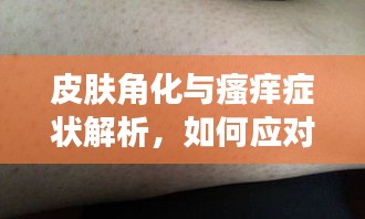 皮肤角化与瘙痒症状解析，如何应对角化带来的困扰？