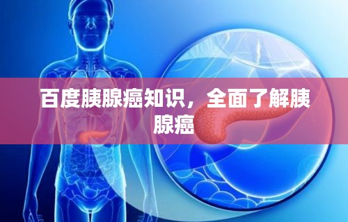 百度胰腺癌知识，全面了解胰腺癌