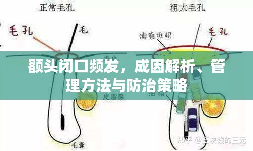 额头闭口频发，成因解析、管理方法与防治策略
