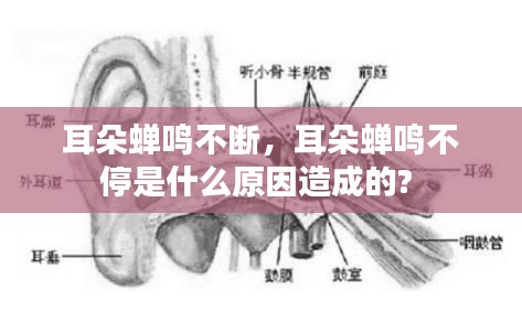 耳朵蝉鸣不断，耳朵蝉鸣不停是什么原因造成的? 