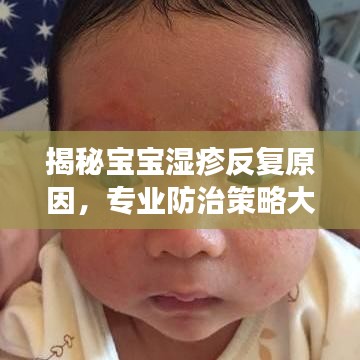 揭秘宝宝湿疹反复原因，专业防治策略大解析！
